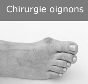 chirurgie-oignons