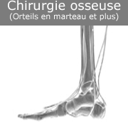 chirurgie-osseuse